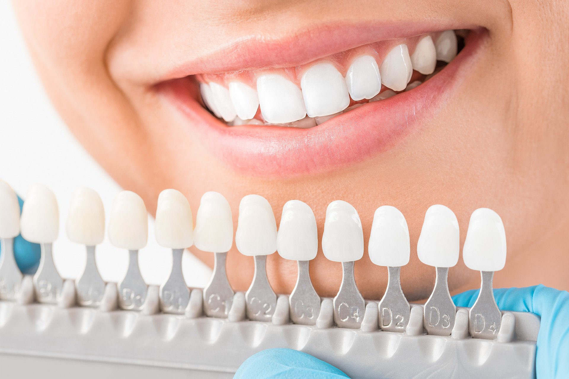 DCS_Dentallabor_DiaShow